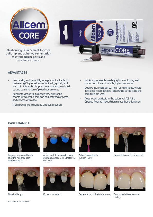 AllCem Core – Dental Progress